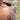 a man using tdp moxa patch